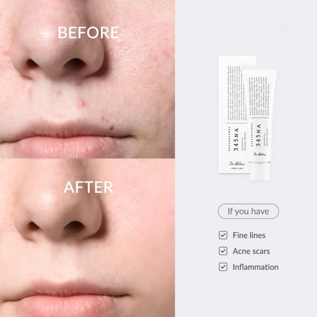 [DR. ALTHEA] 345 Relief Cream 50ml