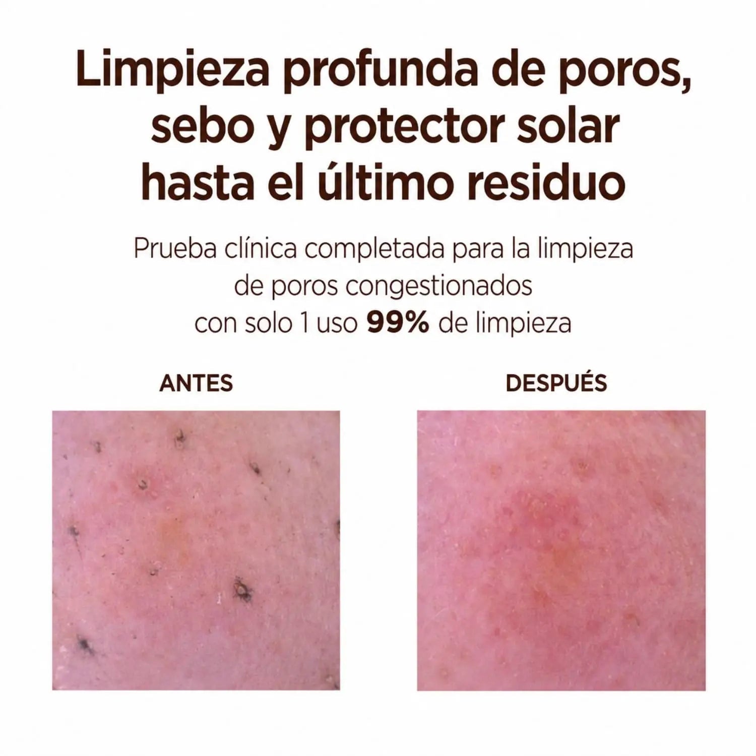 [SKIN1004] Madagascar Centella Poremizing Deep Cleansing Foam 125ml de SKIN1004 | Skincare disponible en kosmic